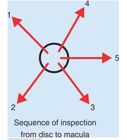 PD - Practical 2 Flashcards | Quizlet 