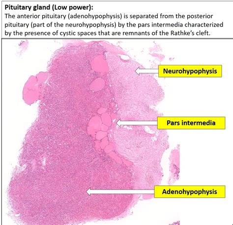 Brain Pituitary Nus Pathweb Nus Pathweb