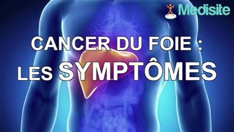 Cancer Du Foie Les Symptômes Vidéo Dailymotion