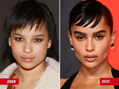 Zoe Kravitz Plastic Surgery Before After PlasticSurgeryInsights