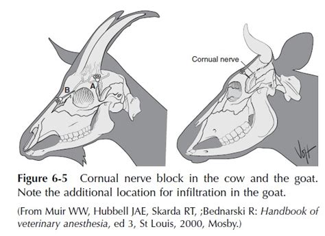 Cornual Nerve Block Hot Sex Picture