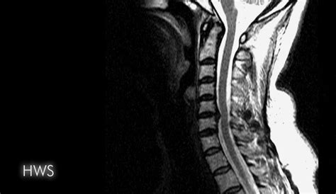 Neuroradiologie Praxis für Radiologische Diagnostik Hanau