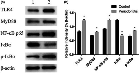 The Role Of Tlr4 Myd88 Nf‐κb Pathway In Periodontitis‐induced Liver