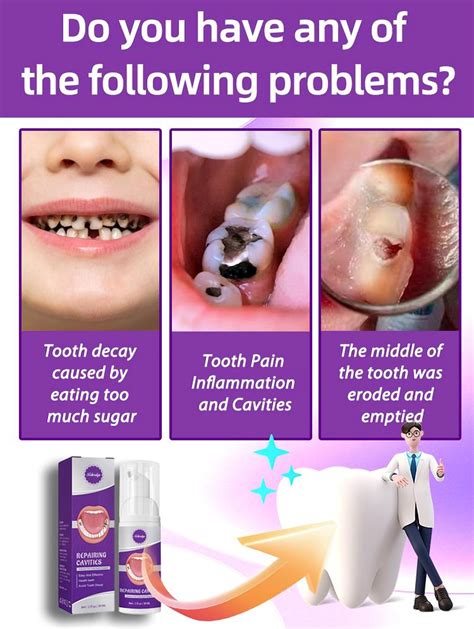 Get Rid of Cavities and Tooth Decay in 2025 | Heal cavities, Tooth