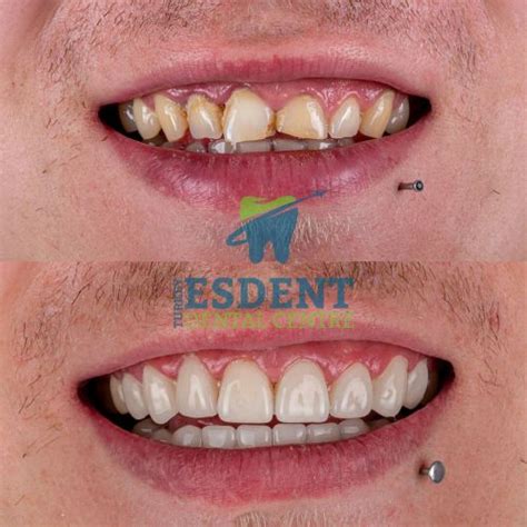 Gallery Esdent Dental Centre