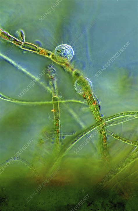 Heliozoans On Green Alga Light Micrograph Stock Image C056 0372