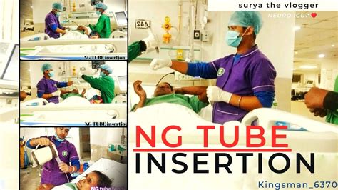 Nasogastric Ng Tube Insertion Osce Guide Patient Procedure Youtube