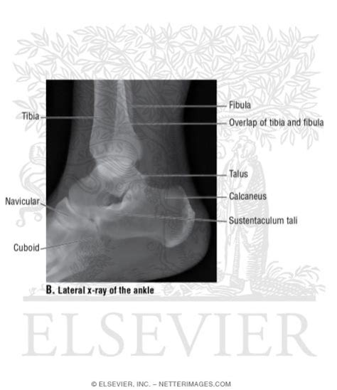 Lateral X Ray Of The Ankle