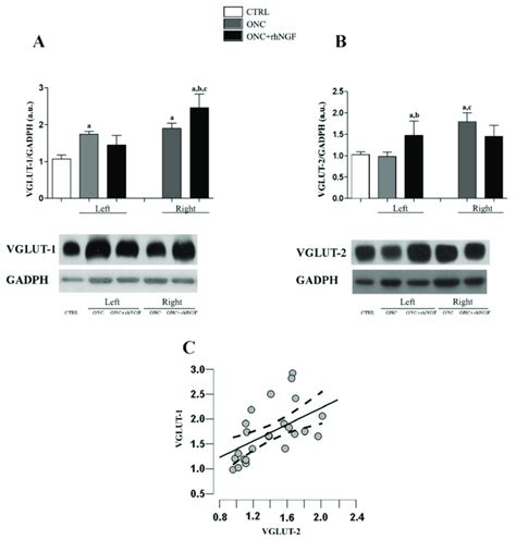 Western Blot Of Vglut 1 And Vglut 2 Level In Visual Cortex Vcx Ab