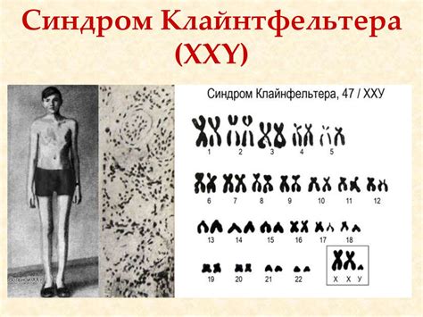 Хромосоми. Каріотип - презентация онлайн
