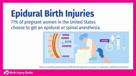 Epidural Birth Injuries Birth Injury Guide