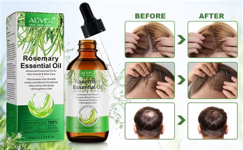 Rosmarin L Haare Ml Rosemary Oil For Hair Rosmarin L Haarwachstum