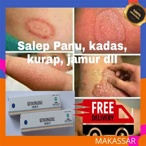 Ketoconazole Krim Salep Jamur Panu Kurap Gatal Selangkangan