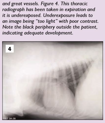 Radiographic film faults Flashcards | Quizlet