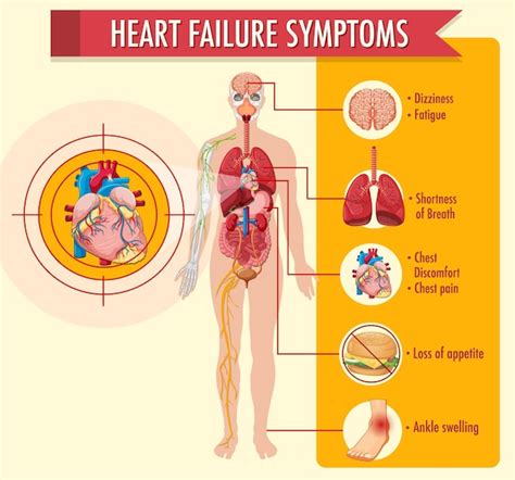 Infografica Informazioni Sui Sintomi Di Insufficienza Cardiaca