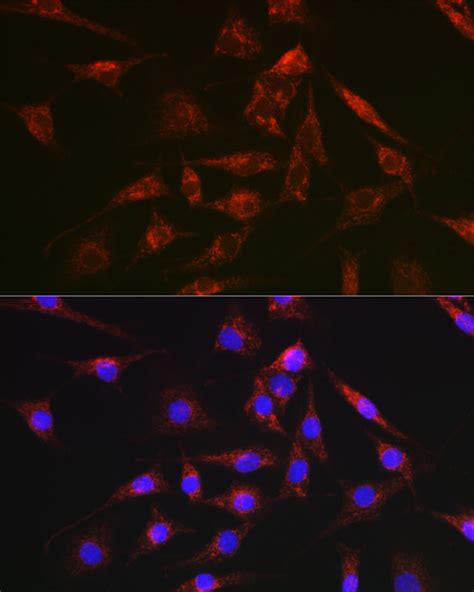 DCN Polyclonal Antibody SAB Signalway Antibody