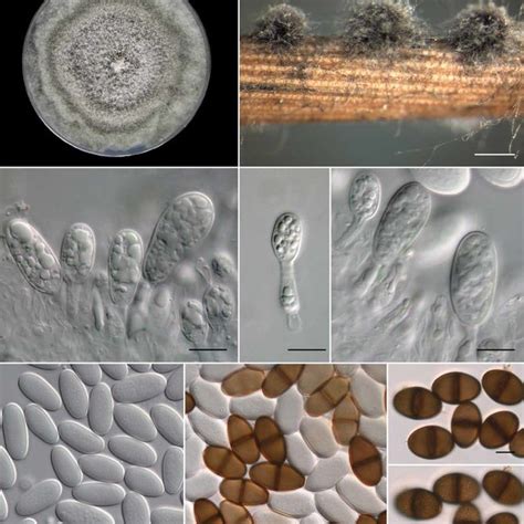Diplodia bulgarica. a. Culture growing on PDA; b. pycnidia developing ...