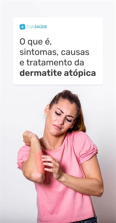 Dermatite atópica o que é sintomas causas e tratamento em 2024