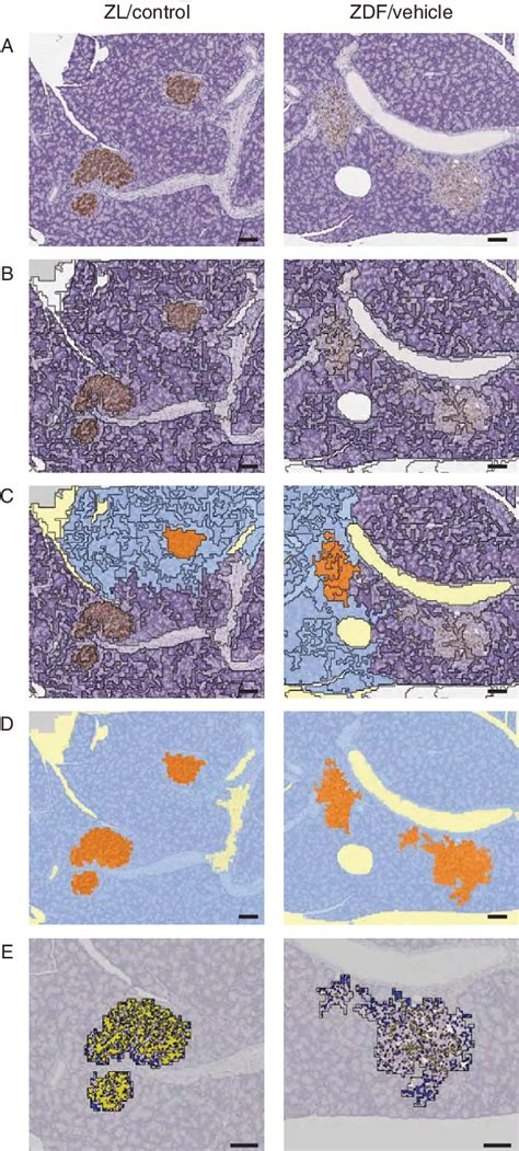 Automated Image Analysis Of Pancreatic Islets Whole Slide Images Of