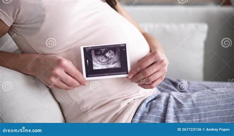 Pregnant Woman with Ultrasound Image Stock Photo - Image of bedroom, pregnancy: 267723136