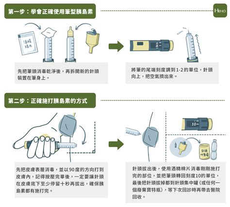 胰島素越早用越好？醫師詳解胰島素是什麼、要怎麼用 Heho健康