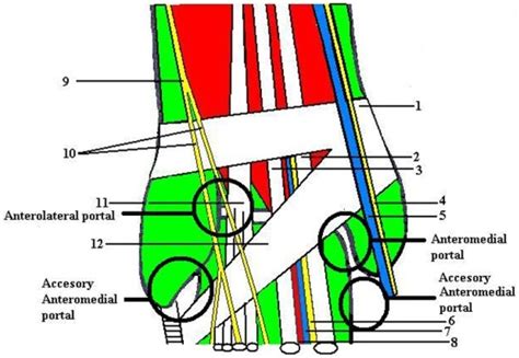 Arthroscopic Ankle and Subtalar Arthrodesis – Indications and Surgical ...