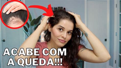 Oq Fazer Pro Cabelo Para De Cair - 5 Dicas para Fazer o Cabelo PARAR DE CAIR - QUEDA CAPILAR O QUE FAZER ...