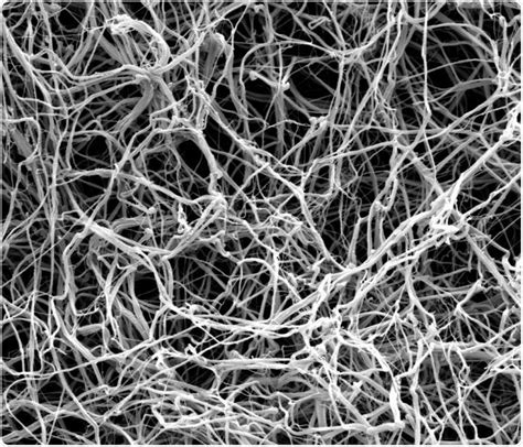 Fibrin Blood Clot