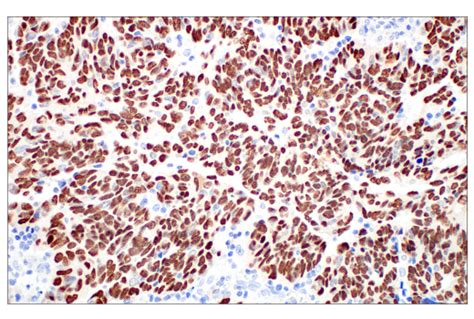 Mage C Ct E B D Xp Rabbit Mab Bsa And Azide Free Cell