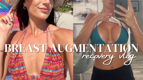 Breast Augmentation Vlog Recovery Experience Intrusive Thoughts