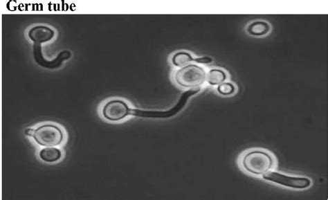 Candida Albicans And A Central True Germ Tube Download Scientific Diagram