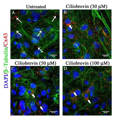 Altered Cx Localization Upon Inhibition Of Cytoplasmic Dynein