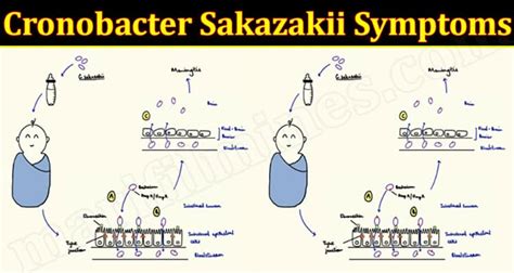 Cronobacter Sakazakii Symptoms {Feb} Prevention & Care