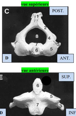 axis C2 vue supérieure et antérieure Diagram Quizlet