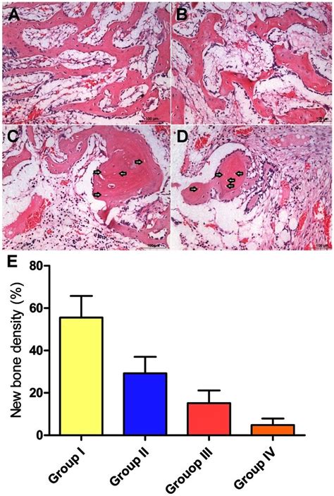 Representative Histological Photomicrograph Of The Necrotic Area Of The