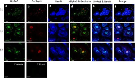 Triple Immunofluorescence Staining Showing Glyrα3 Gephyrin And Neun