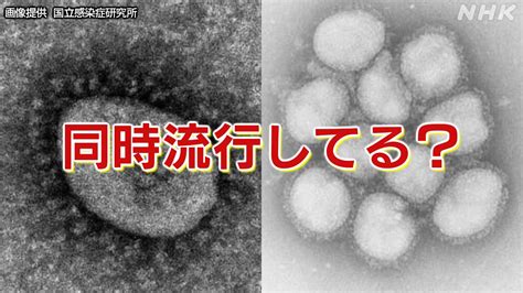 解熱剤やせき止め 薬の供給は？コロナ第8波とインフルエンザ流行で Nhk