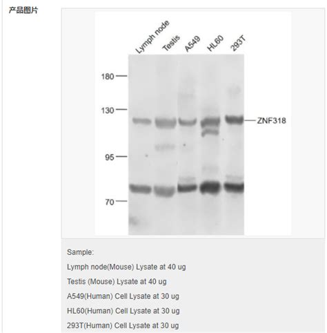 锌指蛋白318抗体 北京拜尔迪生物技术有限公司