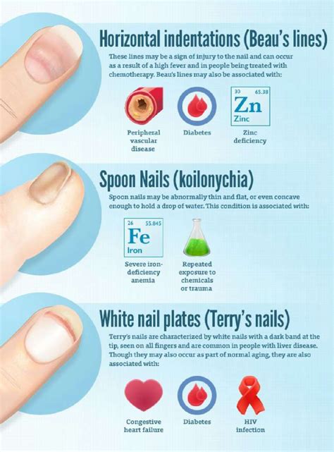 What Your Nails Say About Your Health Health You Nailed It