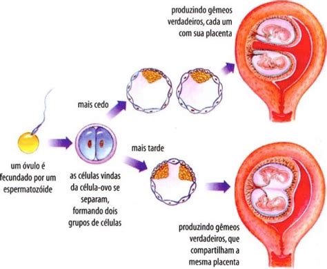 Gravidez De Gêmeos Como Ocorre E Formação Cola Da Web