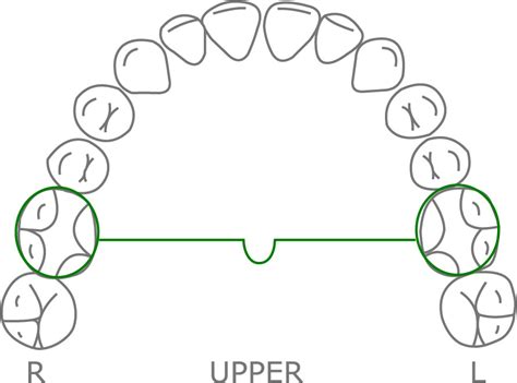 Transpalatal Arch Orthodontic Resource Group