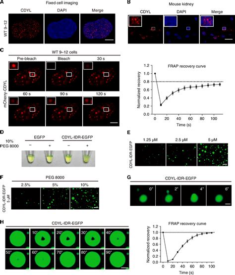 Figure From Nuclear Condensation Of Cdyl Links Histone Crotonylation