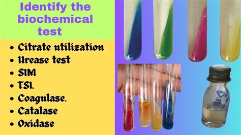 Biochemical Test Bacterial Identification Technique Microbiology