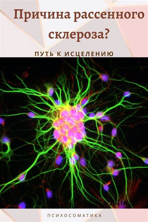 Психосоматика рассеянного склероза. Лечение, отчего возникает ...