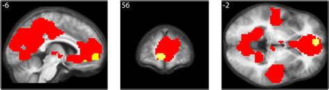 Frontiers The Experience Of Mathematical Beauty And Its Neural Correlates