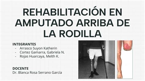 Rehabilitación en amputado arriba de la rodilla GABRIELA NICOLE