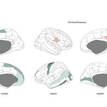 Sex Differences In Variance Ratio Of Slopes For Cortical Surface Area