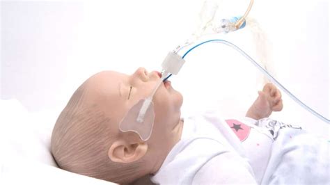 Arcangel™ Neonatal And Pediatric Endotracheal Tube Warriornp