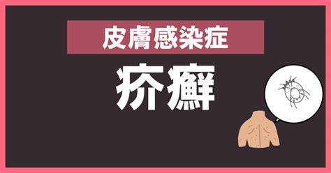 知らない間に発症している皮膚感染症、疥癬 かいせん ｜シニアnet介護