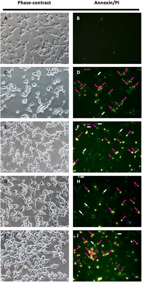 Phase Contrast And Fluorescence Annexin V And Pi Double Staining